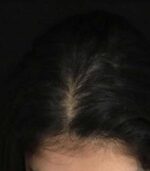 Have Hair Regrowing Spray - Image 3