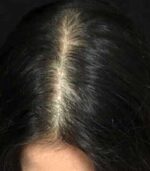Have Hair Regrowing Spray - Image 2