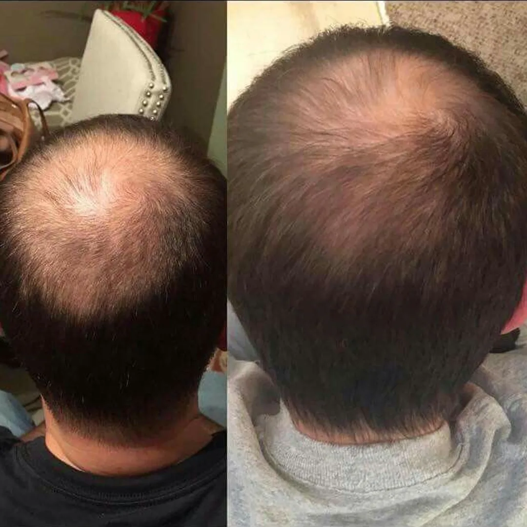 Man Before After